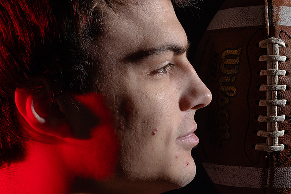 Chatfield's Sam Backer